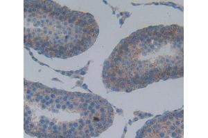 Used in DAB staining on fromalin fixed paraffin- embedded Kidney tissue (SPA17 抗体  (AA 1-140))