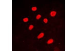 Immunofluorescent analysis of CTBP2 staining in A549 cells. (CTBP2 抗体  (C-Term))