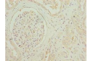 Immunohistochemistry of paraffin-embedded human kidney tissue using ABIN7154541 at diluton of 1:100 (GDF15 抗体  (AA 198-308))