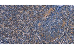 Immunohistochemistry of paraffin-embedded Human tonsil using AGFG1 Polyclonal Antibody at dilution of 1:60 (AGFG1 抗体)