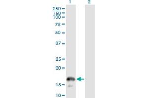 Western Blot analysis of CD247 expression in transfected 293T cell line by CD3Z monoclonal antibody (M01), clone 4A12-F6.