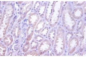 Immunohistochemistry of paraffin-embedded human kidney using TNFRSF10D / TRAIL-R4 / DCR2 antibody at dilution of 1:100. (DcR2 抗体  (FITC))