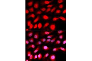 Immunofluorescence analysis of U20S cell using ZEB1 antibody. (ZEB1 抗体)