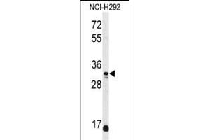 Western blot analysis of DDO Antibody (Center) (ABIN650991 and ABIN2840026) in NCI- cell line lysates (35 μg/lane). (DDO 抗体  (AA 102-130))