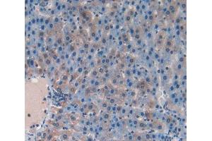 Used in DAB staining on fromalin fixed paraffin- embedded liver tissue (RANKL 抗体  (AA 106-240))