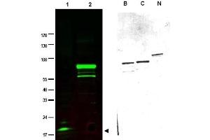 Image no. 1 for anti-SPANX Family, Member C (SPANXC) antibody (ABIN401033) (SPANXC 抗体)