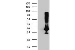 Image no. 2 for anti-Phenylethanolamine N-Methyltransferase (PNMT) antibody (ABIN1500313) (PNMT 抗体)