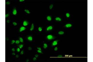 Immunofluorescence of monoclonal antibody to PCAF on HeLa cell. (KAT2B 抗体  (AA 353-452))