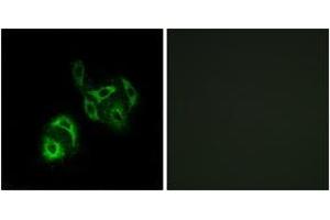 Immunofluorescence (IF) image for anti-Solute Carrier Family 27 (Fatty Acid Transporter), Member 4 (SLC27A4) (AA 61-110) antibody (ABIN1535005)