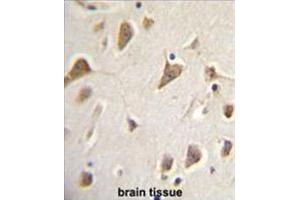 Immunohistochemistry (Paraffin-embedded Sections) (IHC (p)) image for anti-Zinc Finger, MYND-Type Containing 10 (ZMYND10) (AA 328-356), (Middle Region) antibody (ABIN955675)