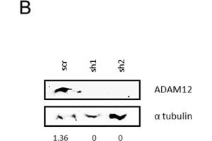 Western Blotting (WB) image for anti-ADAM Metallopeptidase Domain 12 (ADAM12) (AA 589-738) antibody (ABIN6136521)