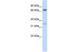WB Suggested Anti-TRIM23 Antibody Titration:  0. (TRIM23 抗体  (N-Term))