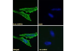 ADRB1 抗体  (Internal Region)