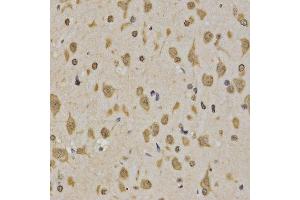 Immunohistochemistry (IHC) image for anti-Histone 3 (H3) (H3K4me3) antibody (ABIN3023254)
