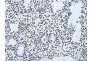 Rabbit Anti-CELF2 Antibody       Paraffin Embedded Tissue:  Human alveolar cell   Cellular Data:  Epithelial cells of renal tubule  Antibody Concentration:   4.