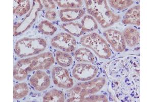 Immunohistochemical analysis of paraffin-embedded human kidney, using Caspase-3 p12 Antibody. (Recombinant Caspase 3 p12 抗体)