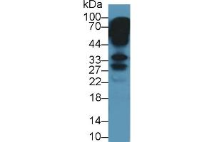 Detection of KERA in Mouse Eye lysate using Polyclonal Antibody to Keratocan (KERA) (KERA 抗体  (AA 21-292))