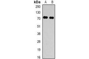 Western blot analysis of TBRG4 expression in Hela (A), HepG2 (B) whole cell lysates. (TBRG4 抗体)