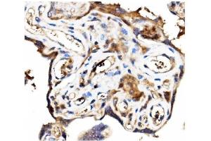 IHC analysis of Stathmin 1 using anti-Stathmin 1 antibody (ABIN3043301). (Stathmin 1 抗体  (N-Term))