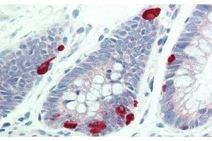 Detection of FUR in Human Colon Tissue using Polyclonal Antibody to Furin (FUR) (FURIN 抗体  (AA 587-748))