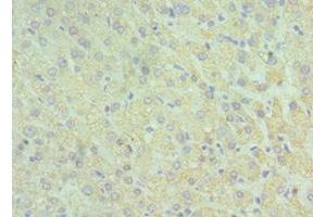 Immunohistochemistry of paraffin-embedded human liver tissue using ABIN7153959 at dilution of 1:100 (GLUD2 抗体  (AA 319-558))