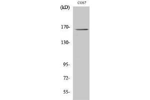 Western Blotting (WB) image for anti-Myomesin 2 (MYOM2) (Internal Region) antibody (ABIN3176183) (MYOM2 抗体  (Internal Region))