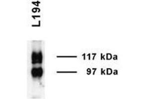 Solute Carrier Family 14 (Urea Transporter, Kidney) Member 2 (SLC14A2) (AA 911-929) 抗体