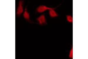 ABIN6267590 staining HeLa by IF/ICC. (MEF2A 抗体  (pThr312))