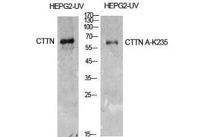 Western Blot (WB) analysis of HepG2-UV cells using Acetyl-Cortactin (K235) Polyclonal Antibody. (Cortactin 抗体  (acLys235))