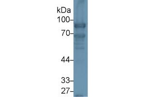 Western Blotting (WB) image for anti-Nexilin (NEXN) (AA 214-455) antibody (ABIN7439642)