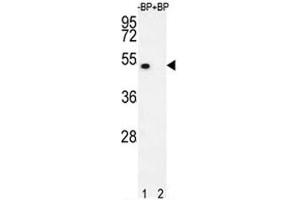 Western blot analysis of E2F1 antibody pre-incubated without (lane 1) and with (2) blocking peptide in 293T lysate.