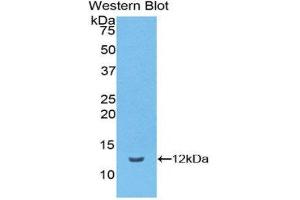 Western Blotting (WB) image for anti-Vitronectin (VTN) (AA 19-111) antibody (ABIN1174143)