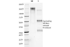 SDS-PAGE Analysis Purified Collagen VII Mouse Monoclonal Antibody (LH7. (COL7A1 抗体)