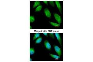 Immunofluorescence (IF) image for anti-Creatine Kinase, Brain (CKB) antibody (ABIN2855158)