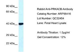 WB Suggested Anti-PRKACB Antibody Titration: 0. (PRKACB 抗体  (Middle Region))