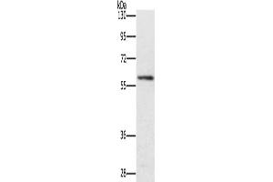 Gel: 8 % SDS-PAGE, Lysate: 40 μg, Lane: Mouse spleen tissue, Primary antibody: ABIN7131459(TRAFD1 Antibody) at dilution 1/400, Secondary antibody: Goat anti rabbit IgG at 1/8000 dilution, Exposure time: 4 minutes (TRAFD1 抗体)
