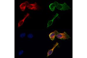 ABIN6260962 and ABIN6268678 staining HepG2 by IF/ICC. (GJB1 抗体  (Internal Region))