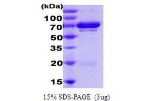Figure annotation denotes ug of protein loaded and % gel used. (UBE2G1 蛋白)