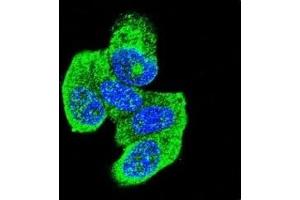 Confocal immunofluorescent analysis of H-RAS antibody with MCF-7 cells followed by Alexa Fluor 488-conjugated goat anti-rabbit lgG (green). (HRAS 抗体  (AA 146-176))