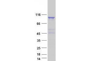 Western Blotting (WB) image for Rap Guanine Nucleotide Exchange Factor (GEF) 3 (RAPGEF3) (Transcript Variant 3) protein (Myc-DYKDDDDK Tag) (ABIN2730489)