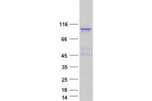 Validation with Western Blot (RAPGEF3 Protein (Transcript Variant 3) (Myc-DYKDDDDK Tag))