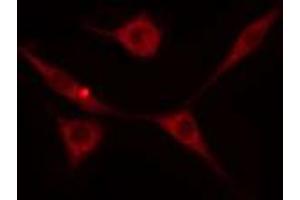 ABIN6274237 staining HeLa cells by IF/ICC. (GRK5 抗体  (Internal Region))