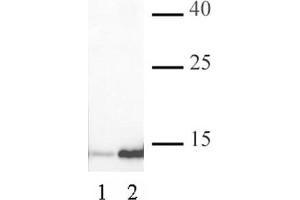 Histone H3K4ac antibody (pAb) tested by Western blot. (Histone 3 抗体  (acLys4))