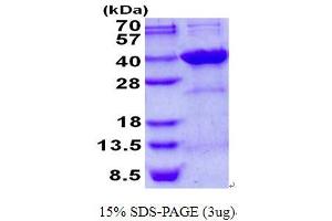 Image no. 1 for Syndecan Binding Protein (Syntenin) 2 (SDCBP2) protein (His tag) (ABIN1098465) (SDCBP2 Protein (His tag))