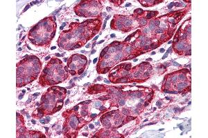 Anti-THRA antibody IHC of human breast. (THRA 抗体  (AA 147-158))