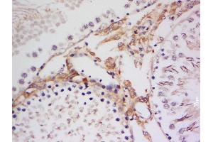 Immunohistochemistry (Paraffin-embedded Sections) (IHC (p)) image for anti-Ribosomal Protein S6 Kinase, 90kDa, Polypeptide 3 (RPS6KA3) (pSer363), (pThr359) antibody (ABIN745208)