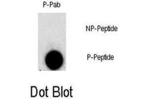 Dot blot analysis of FGFR1 (phospho Y307) polyclonal antibody  on nitrocellulose membrane. (FGFR1 抗体  (pTyr307))