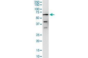 PPP3CA monoclonal antibody (M03), clone 2G8.