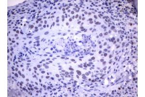 Image no. 1 for anti-Mdm2, p53 E3 Ubiquitin Protein Ligase Homolog (Mouse) (MDM2) (AA 119-438) antibody (ABIN1490872) (MDM2 抗体  (AA 119-438))