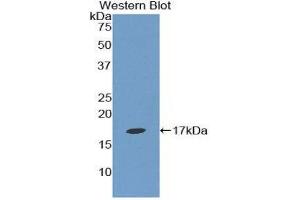 Western Blotting (WB) image for anti-Epsin 1 (EPN1) (AA 279-437) antibody (ABIN1858728) (Epsin 1 抗体  (AA 279-437))